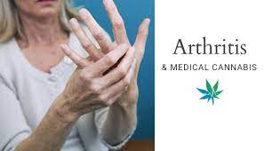 Powerful Herbal Therapies for Arthritis Pain Management
